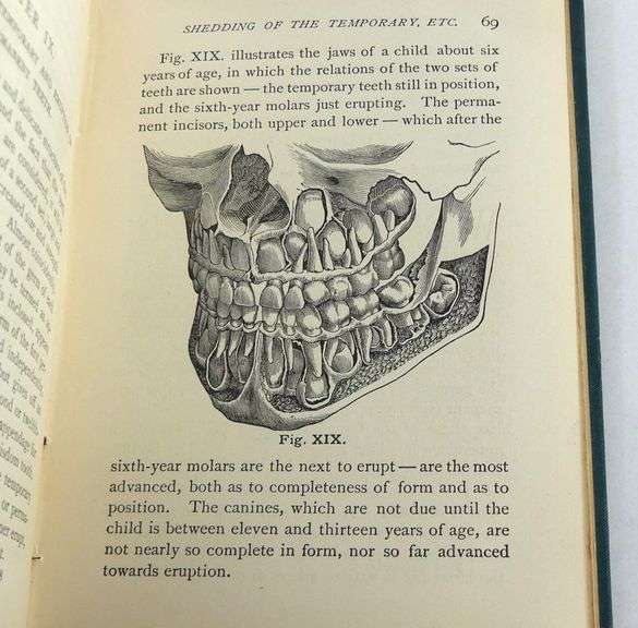 THE MOUTH AND THE TEETH 1879 FIRST EDITION