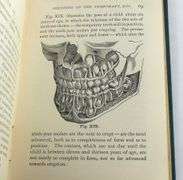 THE MOUTH AND THE TEETH 1879 FIRST EDITION