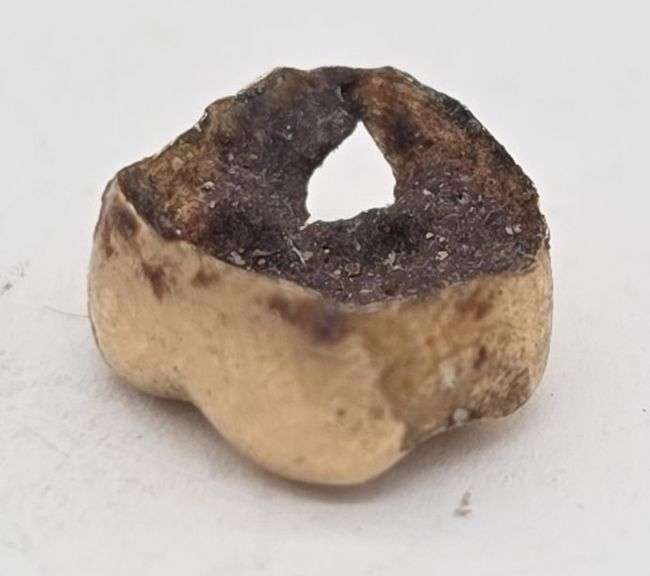 (F) Dental Gold, Total weight 2.17 grams
