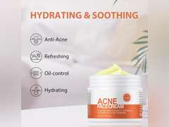 Acne Cream, Salicylic Acid Cystic Acne Treatment For Face, Back Butt Acne Treatments Creams, Acne Spot Treatment for Face Body, Acne Clearing Pimple Cream for Teens & Adults, Acne Moisturizer 10