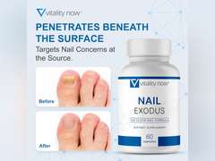 Nail Exodus - Vitality Healthy Nails - Premium Formula for Healthier Feet - 60 Capsules - Pack of 4 215