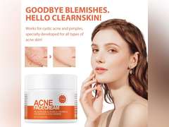 Acne Cream, Salicylic Acid Cystic Acne Treatment For Face, Back Butt Acne Treatments Creams, Acne Spot Treatment for Face Body, Acne Clearing Pimple Cream for Teens & Adults, Acne Moisturizer 10