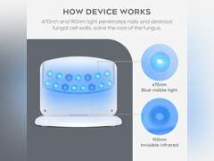 (Black)Nail Fungus Light Device for Multiple Fingernails & Toenails, Home Use Nail Light Device for Restores Appearance of Discolored or Damaged Nails, Effective & Reliable, Whiteboard 89